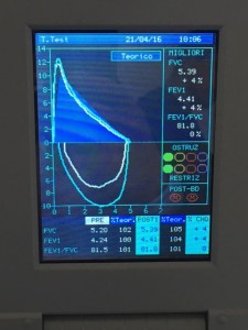 Spirometria forzata FVC fatta con mir spirolab III