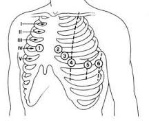 corretto posizionamento degli elettrodi precordiali di un ecg con visualizzazione dello sterno e degli spazi intercostali