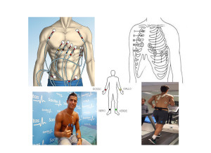 differenti modi per applicare gli elettrodi ecg