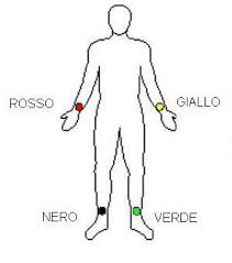 Posizionemento corretto degli elettrodi periferici di un elettrocardiografo 