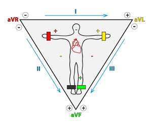 rappresentazione grafica del triangolo di einthoven con le derivazioni d1-d2-d3