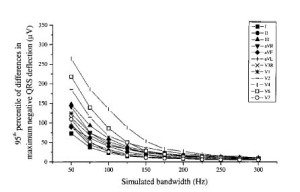 Rappresentazione grafica dell'errore in ampiezza del Qrs utilizzando valori differenti di filtraggio passa basso in ecg neonatale e pediatrico