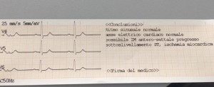 funzione di auto interpretazione di ecg 90A 