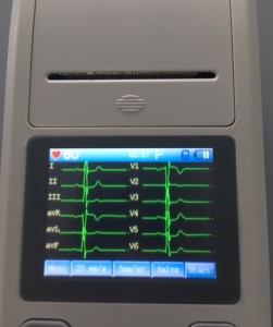 ECG 90A Contec ecg portatile a 12 derivazioni