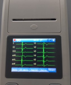 ECG 90A Contec ecg portatile a 12 derivazioni