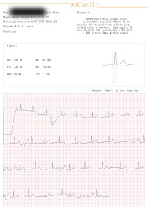 ecg check con smart cardio