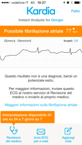 kardia fibrillazione atriale