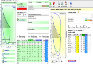 Le differenze tra gli spirometri MIR Minispir e MIR Minispir Light a livello di valori spirometrici riportati dopo il test