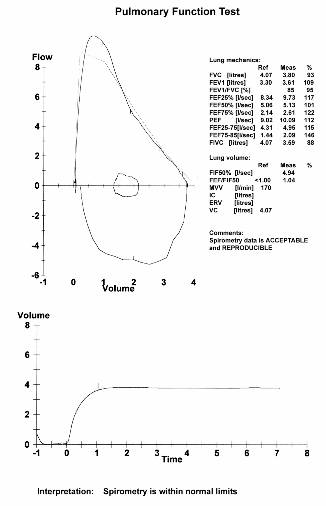 curva flusso volume