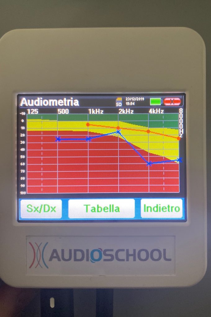 Audiometria su schemro Otowin Lite