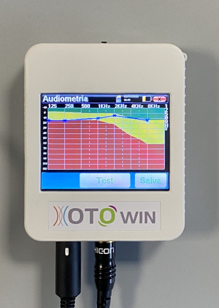 Audiogramma con Otowin in modalità portatile