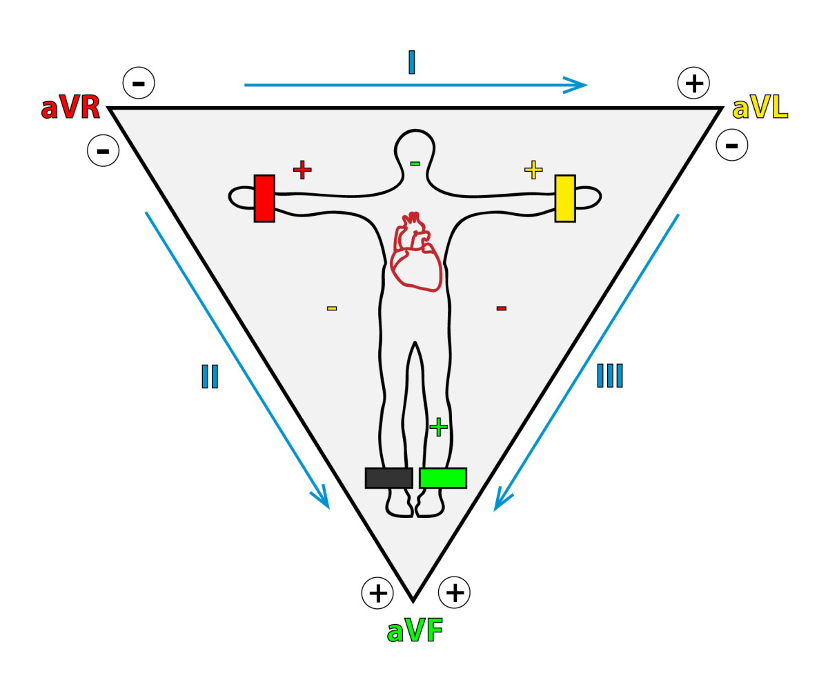 Posizionamento Elettrodi Ecg IppocrateShop Blog posizionamento-elettrodi-ecg-ippocrateshop-blog