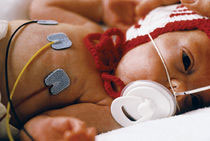 ecg neonatale e pediatrico, nuove linee guida sul filtro passa-basso?