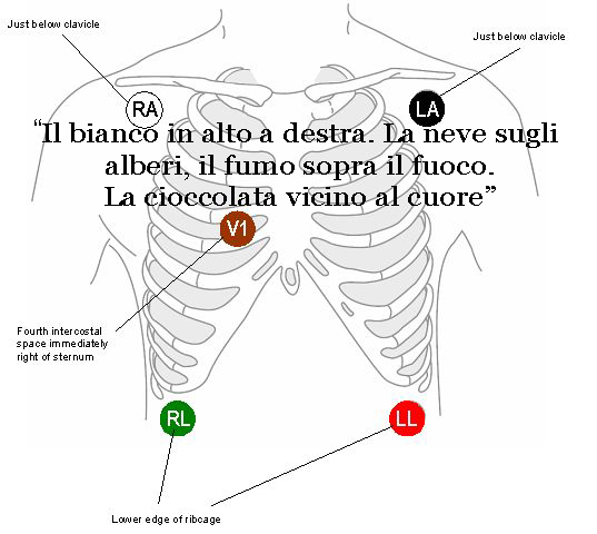 Come posizionare gli elettrodi di un holter cardiaco