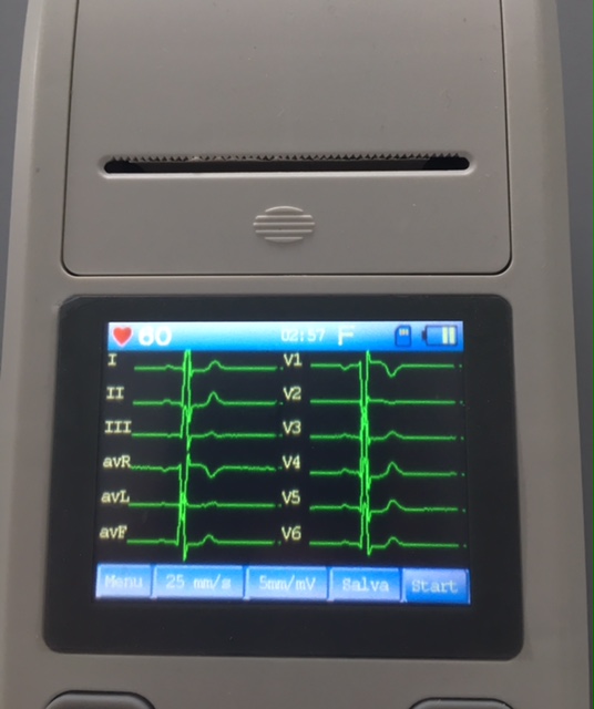 ECG 90A Contec ecg portatile a 12 derivazioni > IppocrateShop Blog