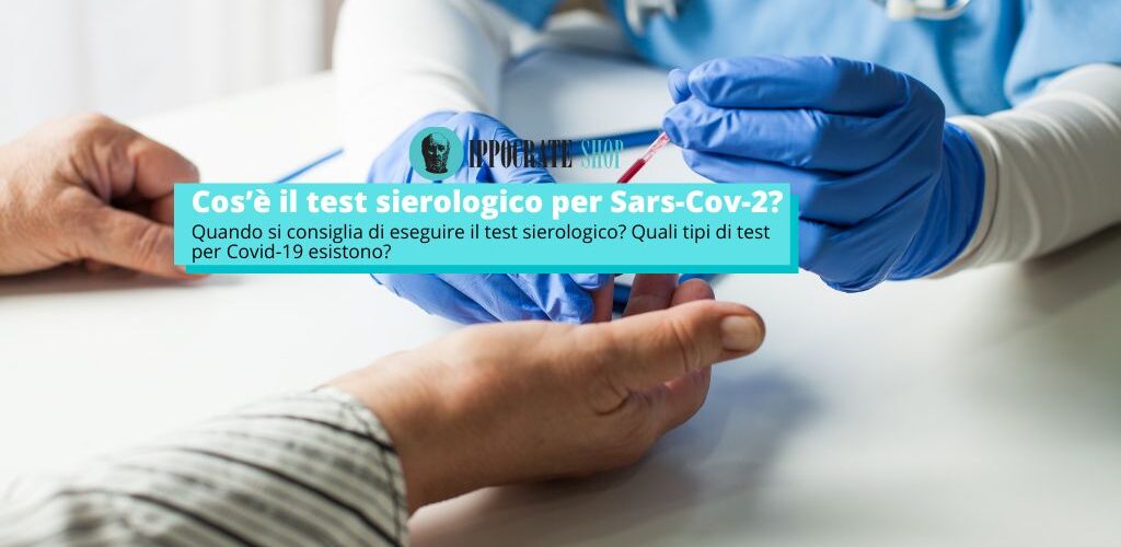 Quando si consiglia di eseguire il test sierologico? Quali tipi di test per Covid-19 esistono?