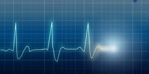refertazioni ecg a consumo