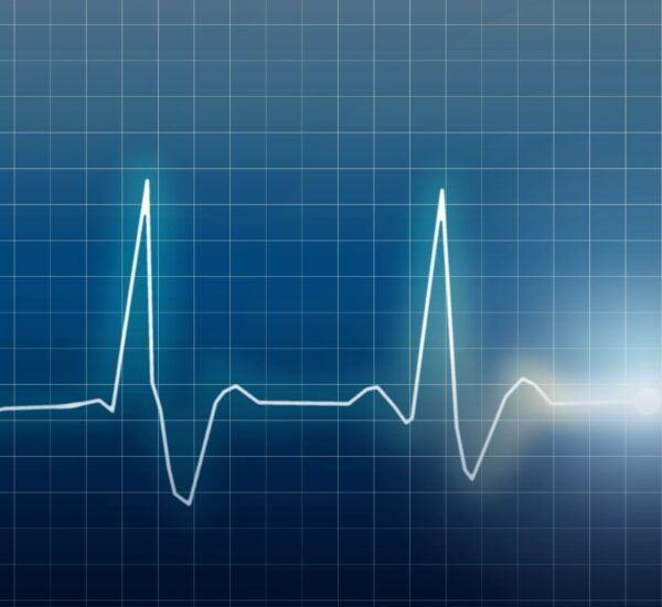 refertazioni ecg a consumo