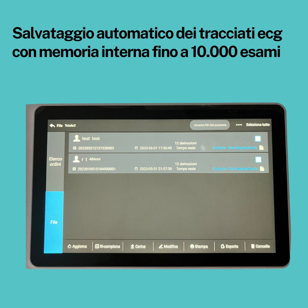 ecg-tablet-12-derivazioni-portatili-lepu-s120 > IppocrateShop Blog