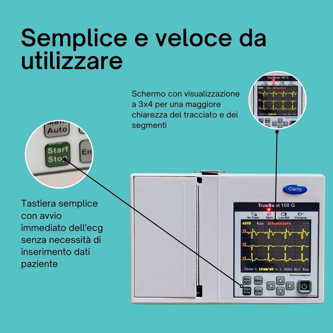 Pharmafiore - WECARDIO Elettrocardiografo Registratore ECG portatile  Elettocardiogramma senza fili a singola derivazione professionale